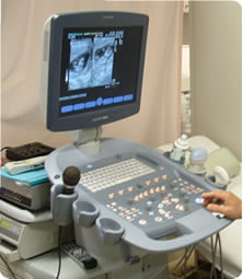 4D超音波診断装置写真
