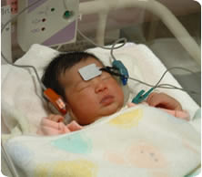 新生児聴力検査イメージ2